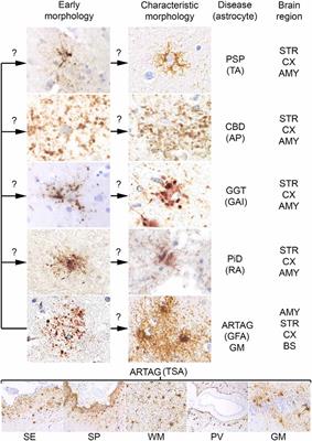 Astroglia and Tau: New Perspectives